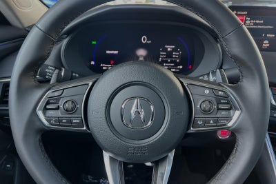 2025 Acura TLX Technology Package